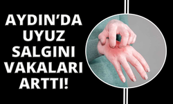 Aydın’da uyuz salgını
