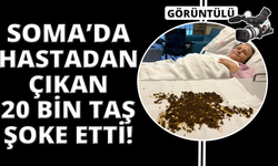 Manisa'da hastadan çıkan taşları sayamadılar