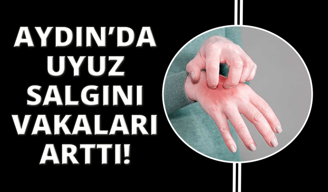 Aydın’da uyuz salgını