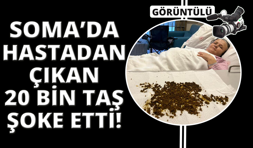 Manisa'da hastadan çıkan taşları sayamadılar