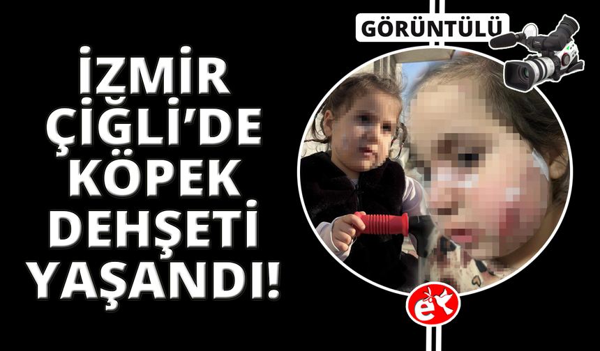 İzmir'de köpek dehşeti: 3 yaşındaki Ada'nın yüzü pençe ve ısırıkla dolu